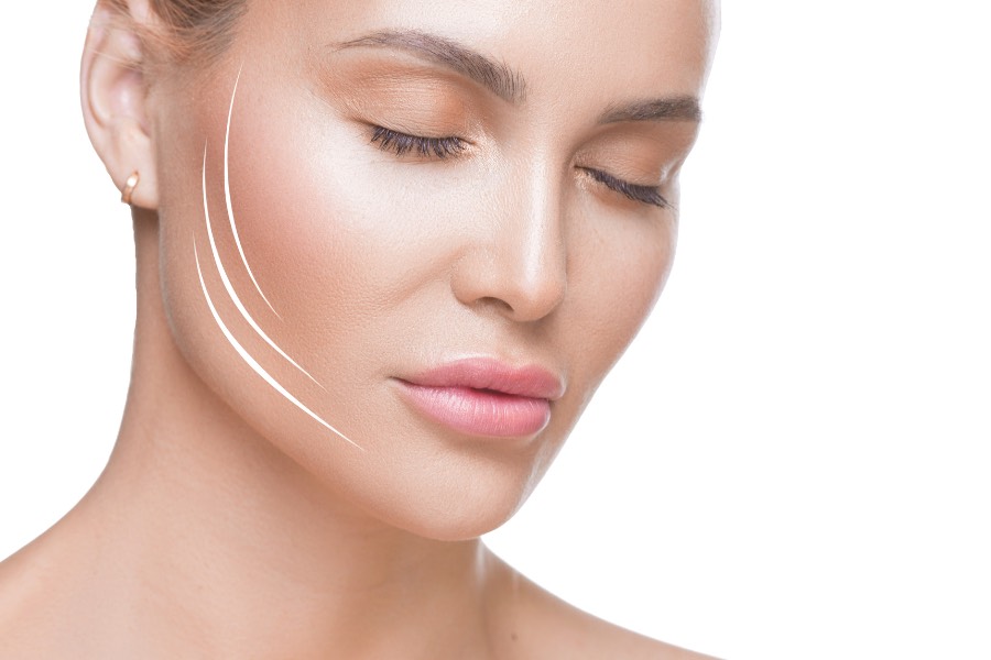 Procedúra ENDOLIFT®